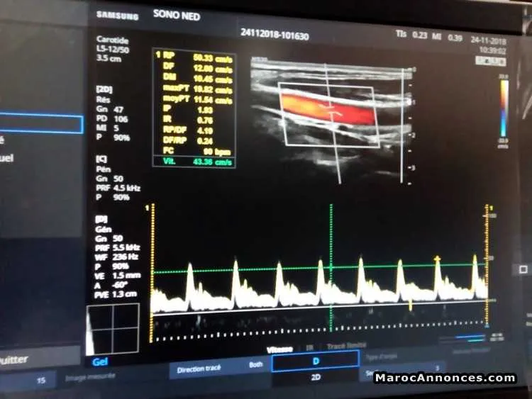 Echographe samsung hs30 - الدار البيضاء (3)