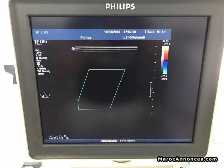 échographe philips ie33 - الدار البيضاء (3)