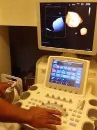 Echographe medison v20 - الدار البيضاء (2)