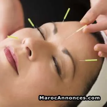 Acupunctrice et réflexoogue - الرباط (2)