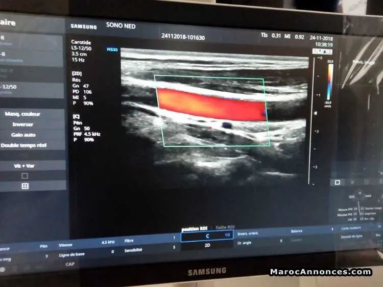 Echographe samsung hs30 - الدار البيضاء (2)