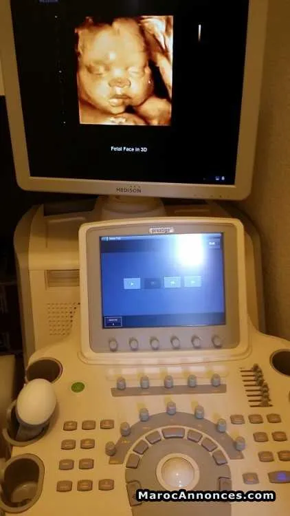Echographe medison v20 - Tout le Maroc