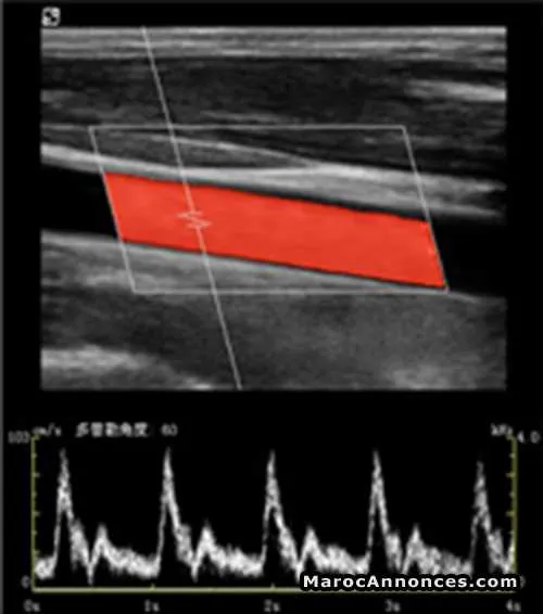 Iustar 300 - الدار البيضاء (2)